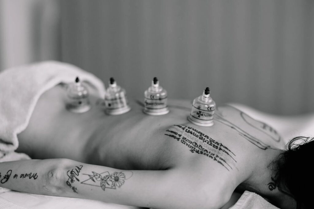 Baňkování (vakuoterapie)